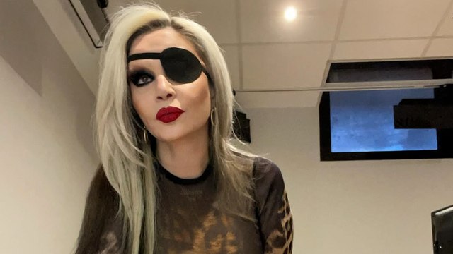 Mario Vaquerizo habla de la salud de Alaska tras sufrir una trombosis en el ojo: Lo pasó muy mal