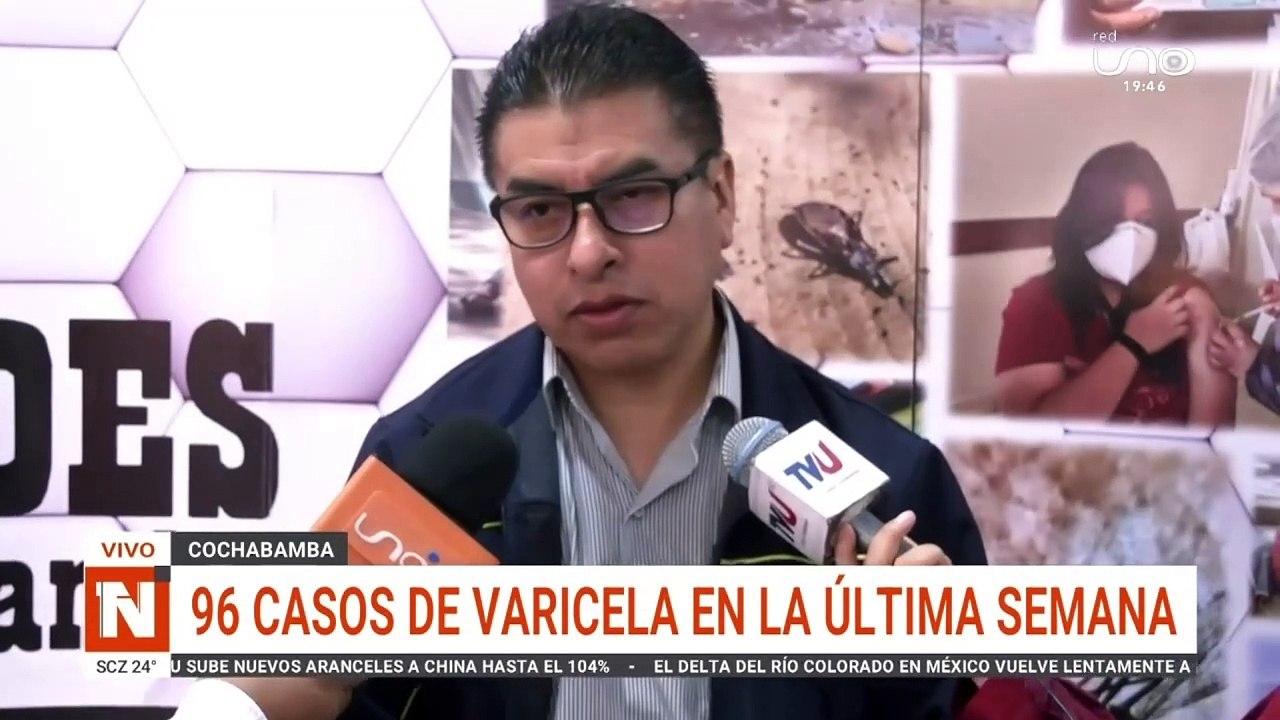Varicela