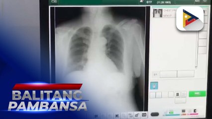 DOH-XI, pinaigting ang active case finding para labanan ang tuberculosis
