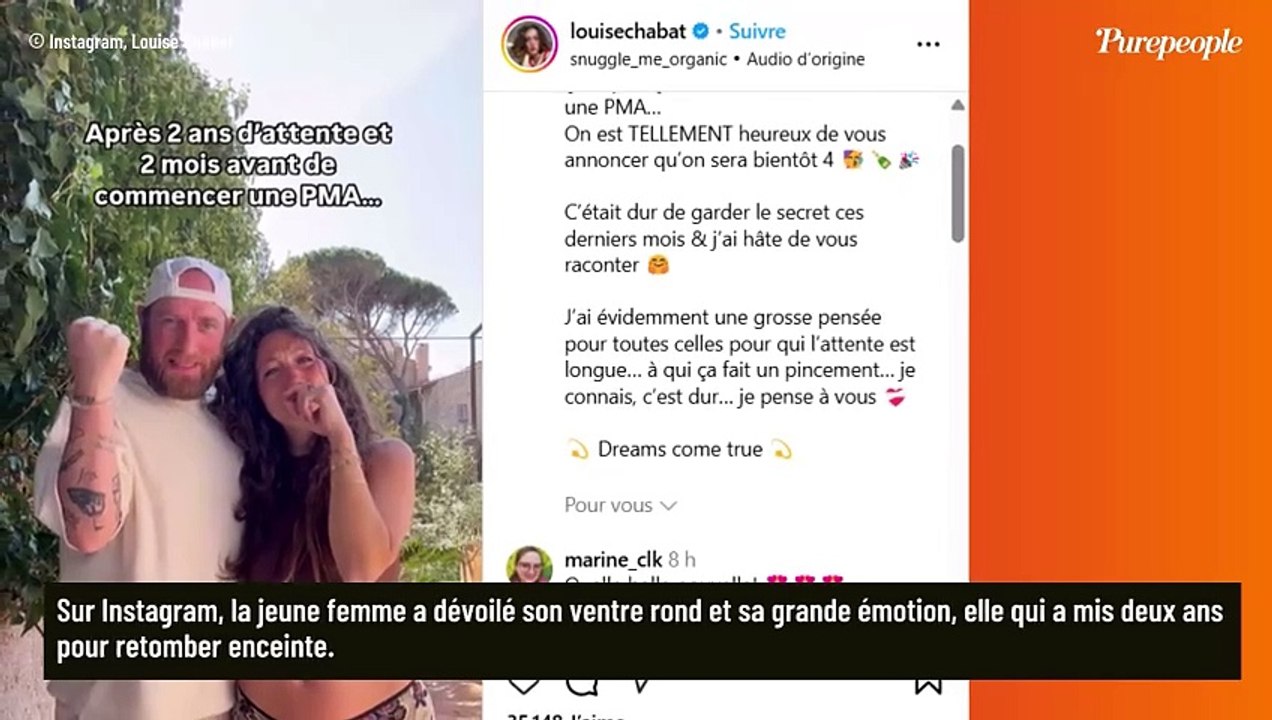 Alain Chabat : Sa fille Louise attend son deuxième enfant "après deux ans d'attente et deux mois avant la PMA”