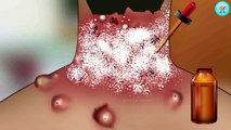 7. ASMR Removal Mggot Infected & Dog Ticks Severely Injured Animation