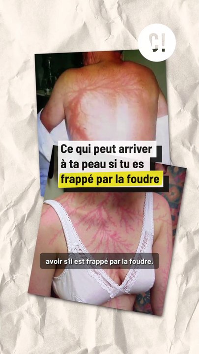 Prendre la foudre : ça fait quoi ?