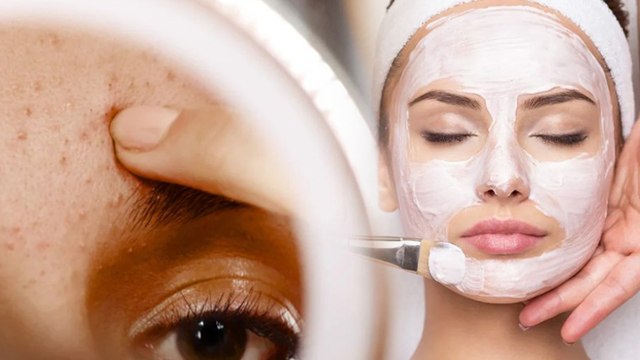 Face Cleanup Kitne Din Me Karna Chahiye | क्लीनअप कितनी बार करना चाहिए | Boldsky