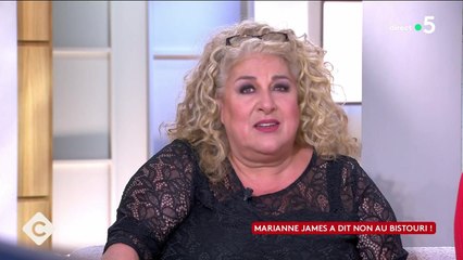 "On a pris rendez-vous" : Marianne James se souvient du jour où elle voulait voir un chirurgien esthétique (VIDÉO)