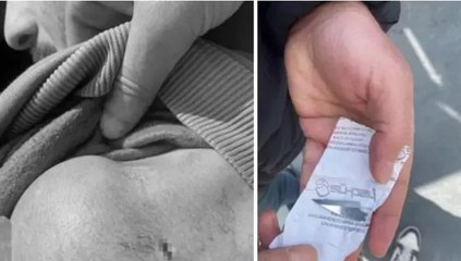 Milli sporcuya eski antrenörü neşterle saldırdı, vücudunda çok sayıda kesik oluştu