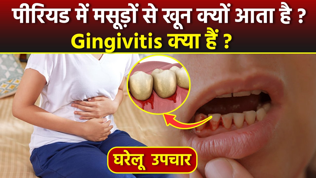 Menstrual Gingivitis Home Remedies: पीरियड में मसूड़ों में सूजन क्यों आती है, Masudo Me Sujan Ka Ilaj