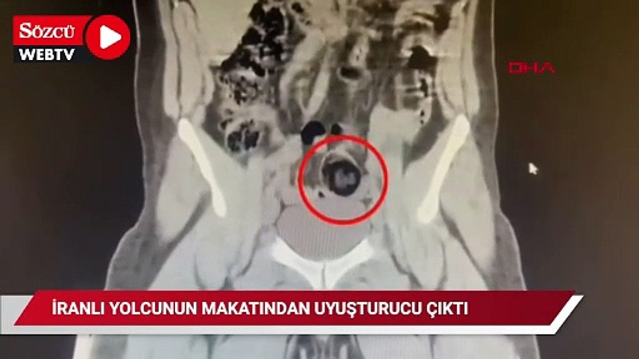 İranlı yolcunun makatından uyuşturucu çıktı