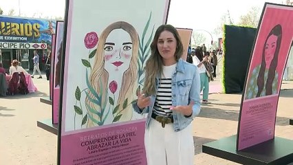 Retratos de Rosácea, una exposición que pone rostro y voz a quienes viven con esta enfermedad