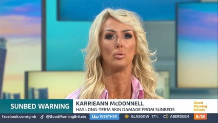 ‘It stings to put my hand under the tap’: Former sunbed user warns of dangers after 12 years of tanning