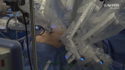 La ‘revolución’ Da Vinci: así es una operación con cirugía robótica