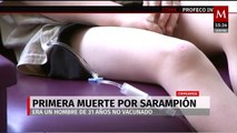 Chihuahua registra primer fallecimiento por sarampión; suman 261 casos en el estado