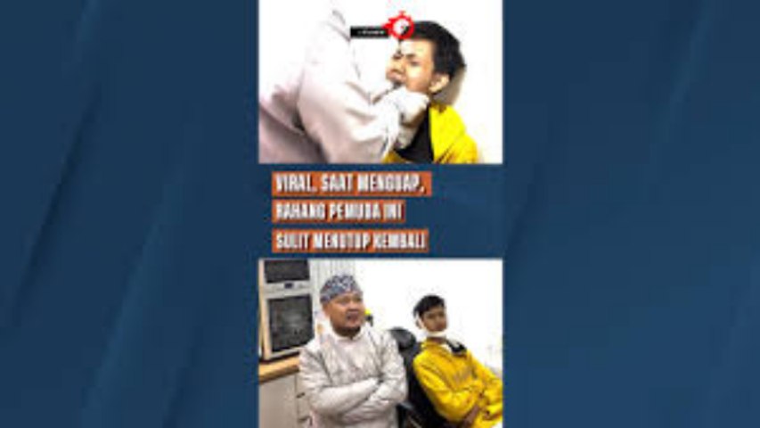Viral, Saat Menguap, Rahang Pemuda Ini Sulit Menutup Kembali (PT)