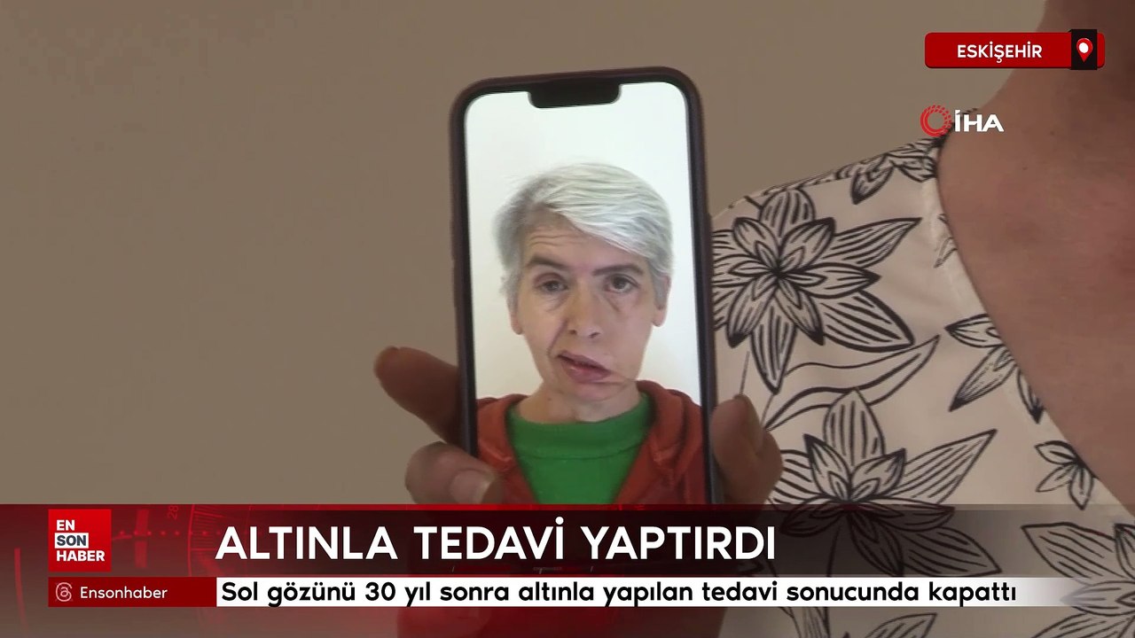 Eskişehir'de sol gözünü 30 yıl sonra altınla yapılan tedavi sonucunda kapattı