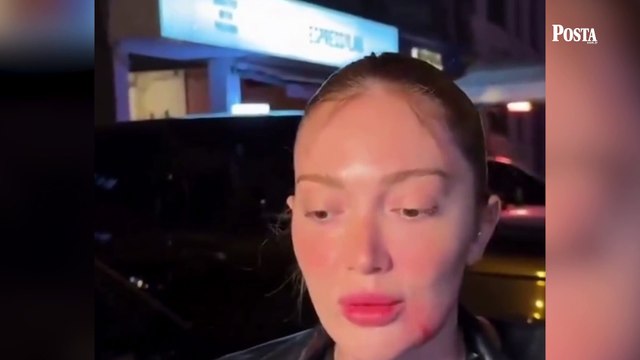 Ünlü fenomen Danla Bilic’ten ilk açıklama: 'Gördüğünüz her şeyde fazlası yok, eksiği var'