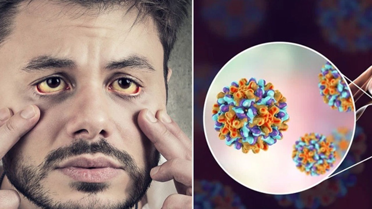 Hepatitis B Causes: Hepatitis B कैसे फैलता है,Symptoms & Treatment | Boldsky