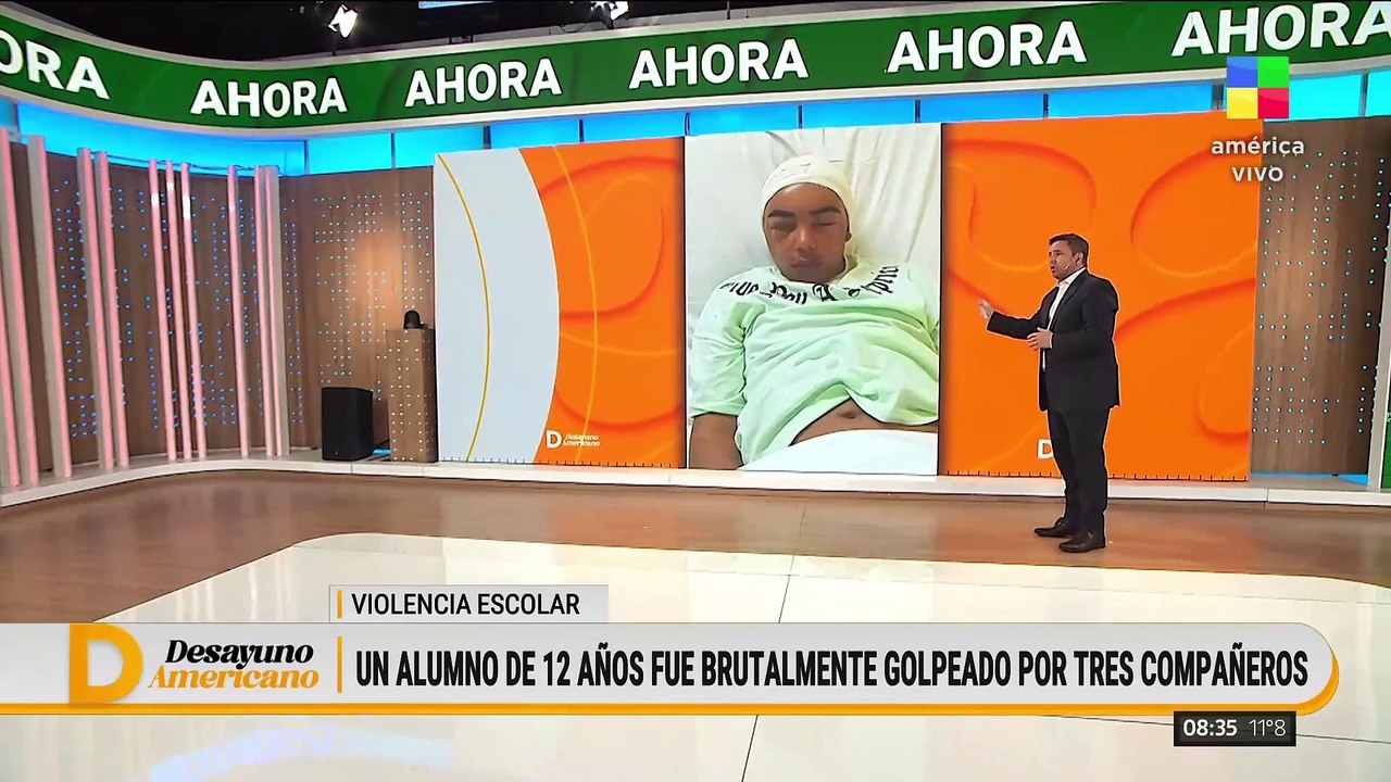 GRAL. RODRÍGUEZ: UN ALUMNO DE 12 AÑOS CASI PIERDE LA VIDA TRAS SER GOLPEADO POR TRES COMPAÑEROS