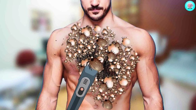 15. ASMR Dirty Hairly Chest & Dog Ticks Removal Deep Cleaning Animation