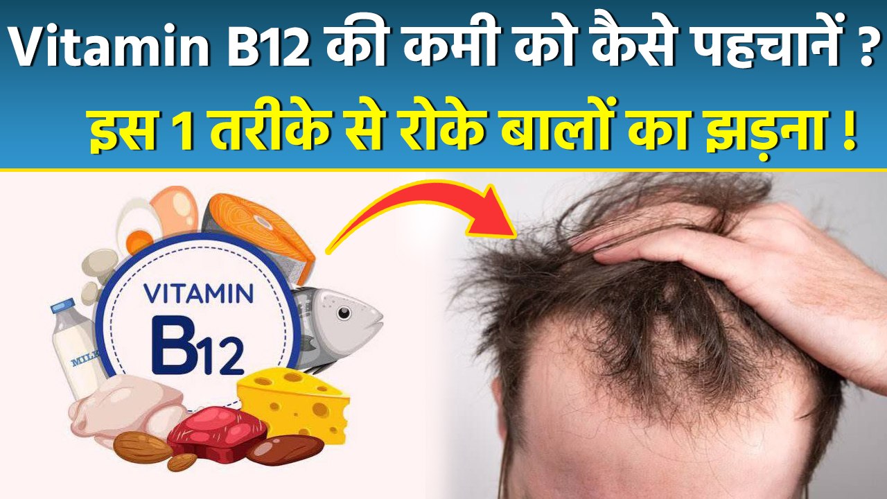 Vitamin B12 Deficiency से Hair Loss क्यों होता है | Vitamin B12 Se Hair Loss Kaise Roke | Boldsky
