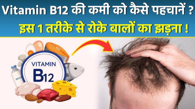 Vitamin B12 Deficiency से Hair Loss क्यों होता है | Vitamin B12 Se Hair Loss Kaise Roke | Boldsky