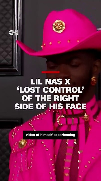 Lil Nas X ‘lost control’ of the right side of his face