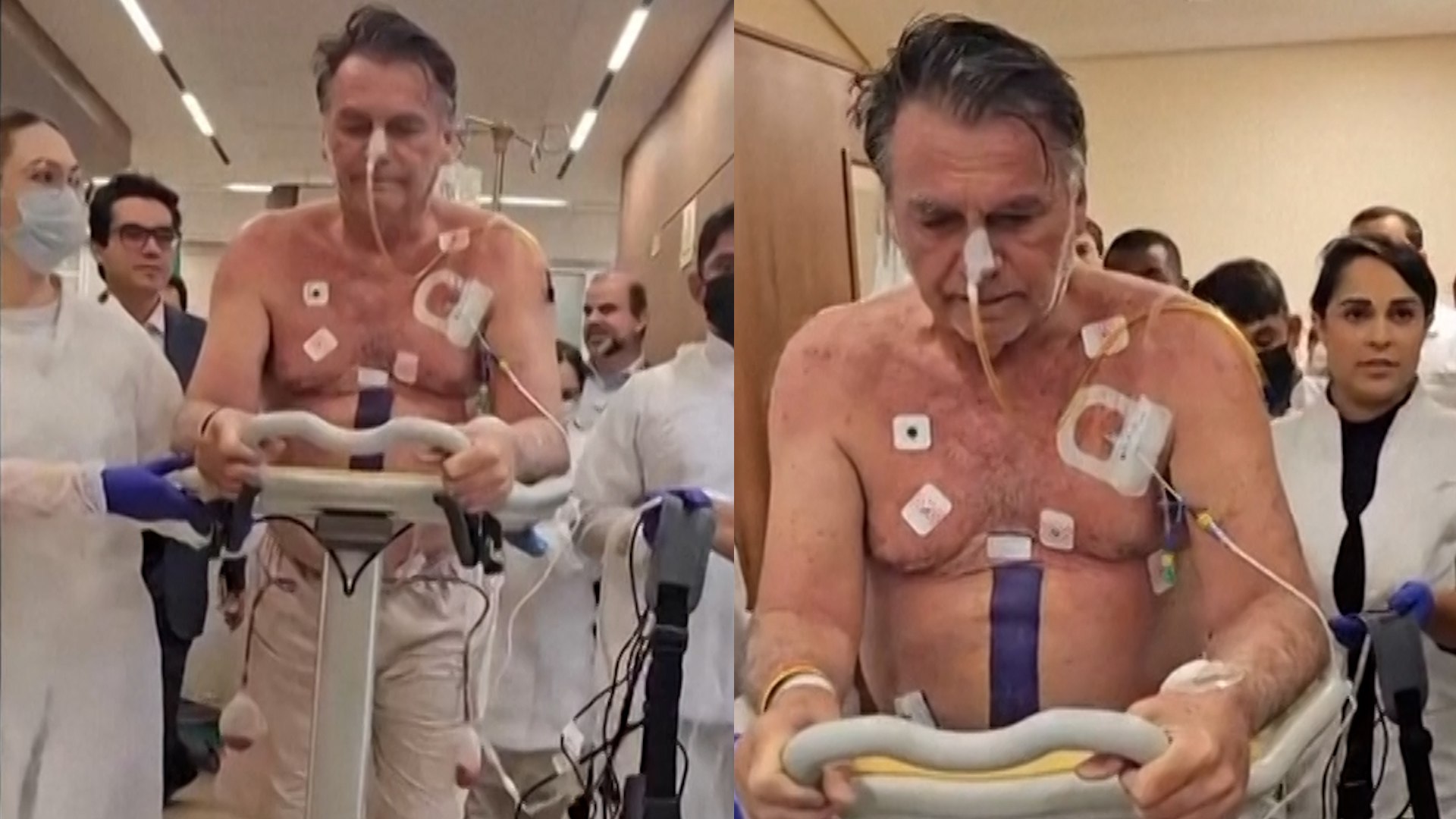 El ex presidente de Brasil, Jair Bolsonaro, comparti� el martes en las redes sociales im�genes de su recuperaci�n en el hospital, donde permanece en cuidados intensivos tras una cirug�a intestinal.
El l�der de extrema derecha, que ha comenzado fisioterapia, comparti� un video en donde camina por los pasillos del Hospital DF Star de Brasilia con apoyo m�dico.