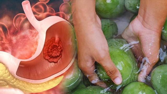 Mango Causes Gas: आम खाने से गैस बनती है क्या | Aam Khane Se Gas Banti Hai Kya | Boldsky