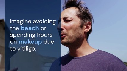 Vitiligo Camouflage Tattoo A Life-Changing Solution to Restore Your Skin Tone