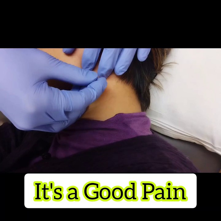 Needling