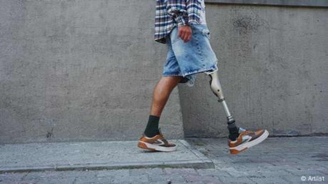 Günstigere Prothesen dank 3D-Druck