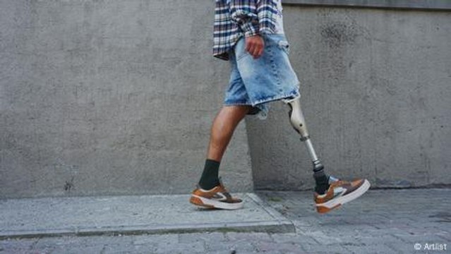 Kenyan company use 3D printing to make low-cost prostheses