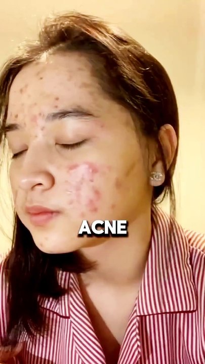 Korean Face Mask Quick result 👌 😌 😍