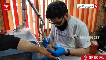 کشمیری نوجوانوں میں ٹیٹو ہٹوانے کا رجحان کیوں بڑھ رہا ہے