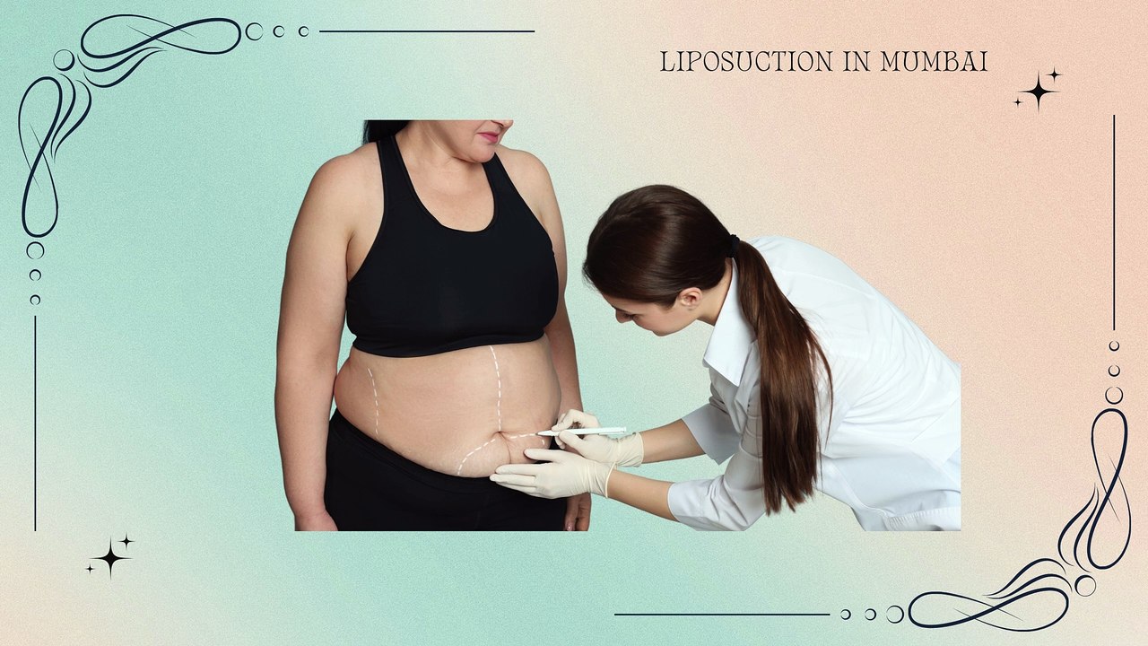 Does Fat Grow Back After Liposuction