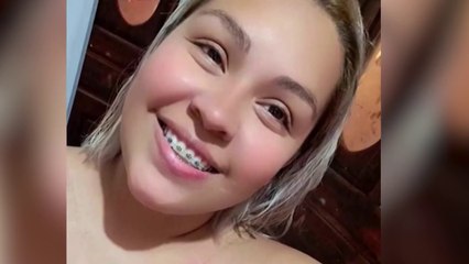 tn7-Joven-madre-de-Cartago-atacada-con-ácido-se-recupera-poco-a-poco-210524