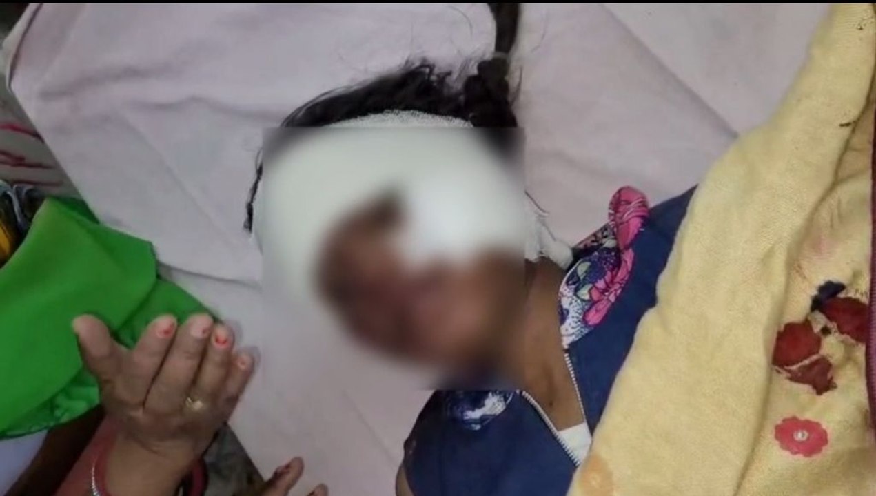 श्वानों के झुंड ने 13 साल की किशोरी को 30-40 जग...