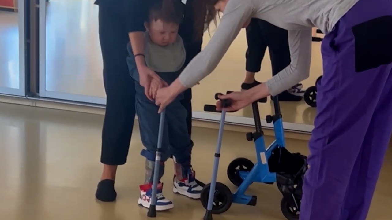 Tapferes Kleinkind mit seltenem Syndrom läuft zum ersten Mal