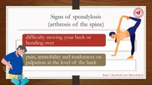 Symptoms (signs) of spondylosis (arthrosis of the spine)