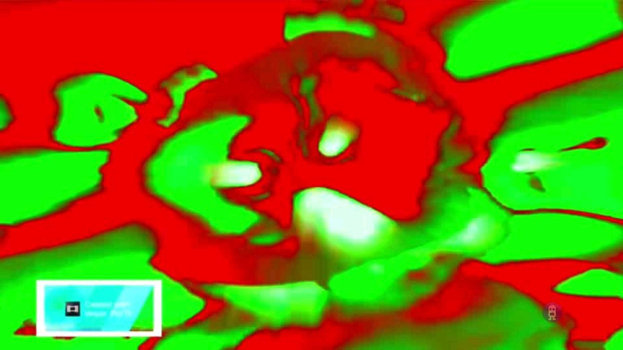 Preview 2 Gummy Bear Electronic Sounds Effects (Preview 2 Effects) Reversed