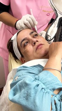 Tired of spending time and money on waxing, threading, or shaving every few days Face laser gives you long-lasting smooth skin, no ingrown hairs, and zero razor burns—just freedom from the constant cycle.To bo