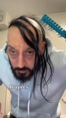 👨🏼‍🦲Anecdotes et autres histoires sur la CALVITIE !