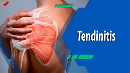 Actitud Saludable | Tendinitis de hombro: síntomas que no se deben ignorar