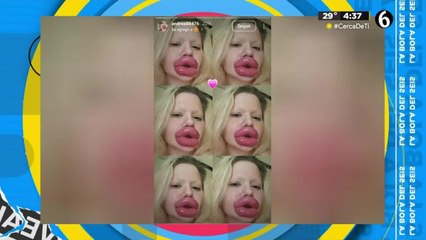 La Bratz humana tiene los labios más grandes