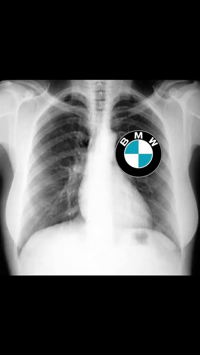 "BMW: The Ultimate Driving Machine Redefined"