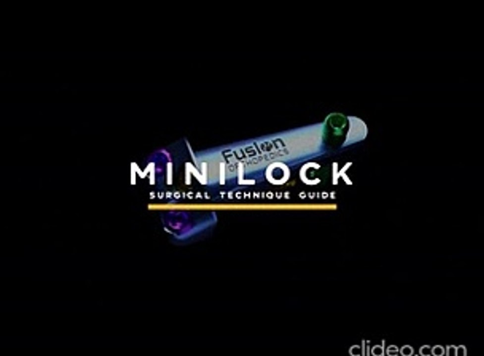 minilock-minimally-invasive-bunion-correction-surgical-technique-1_GblJ9R63