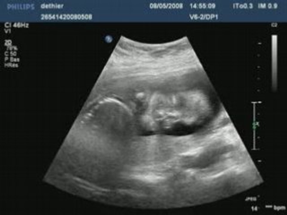 Dethier20080508145509083