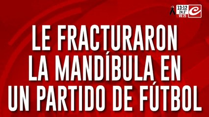 Brutal agresión: le fracturaron la mandíbula en un partido de fútbol