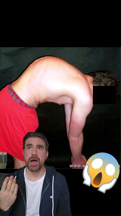 😱😥 Tu ne veux pas finir comme ça ? Il est important de prendre soin de son dos !Je te parle des An Mo, massages qui utilisent la médecine traditionnelle chinoise.#massage #conseil #bienêtre #soins #méditationCollaboration commerciale invitation