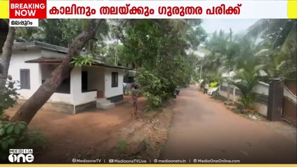 തെരുവുനായയുടെ കടിയേറ്റ അഞ്ചര വയസുകാരിക്ക് പ്രതിരോധ വാക്സിൻ എടുത്ത ശേഷവും പേവിഷബാധ.