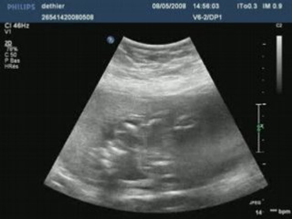 Dethier20080508145603237