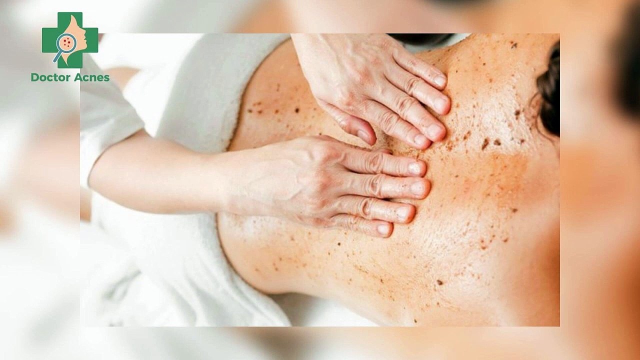 Mụn ẩn ở lưng: nguyên nhân và cách điều trị hiệu quả